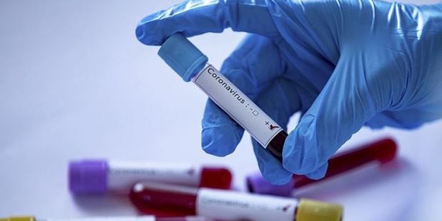 ABD’de koronavirüsten ölenlerin sayısı 120 bin 691