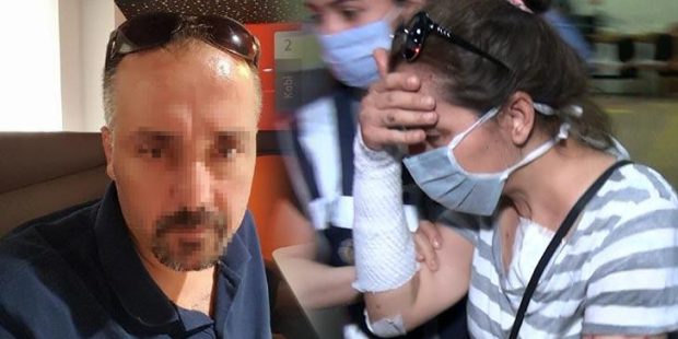 Eski erkek arkadaşının yüzüne kezzap atan kadın tutuklandı!