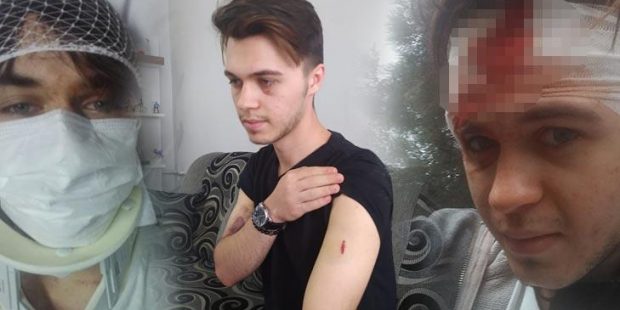 Son dakika... Arkadaşıyla parkta oturan gence sopalı saldırı!