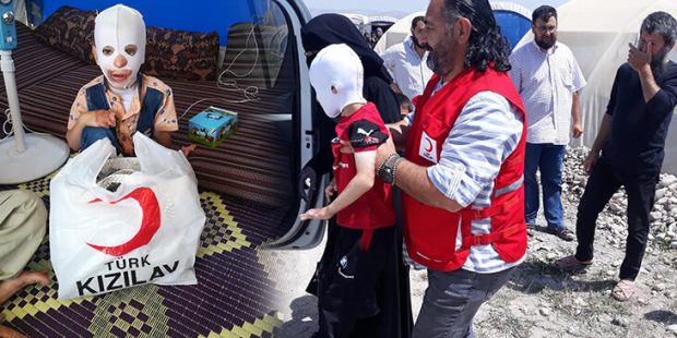 Vücudu yanan Suriyeli Halid'in tedavisi Türkiye'de yapılacak