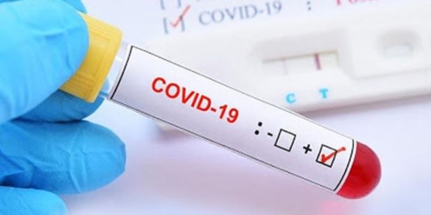 Koronavirüs: Bazı Covid-19 hastaları neden koku ve tat alma duyularını yitiriyor?